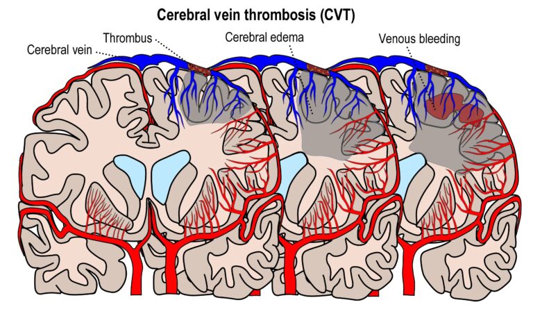 Medical illustration from Vitals Daily