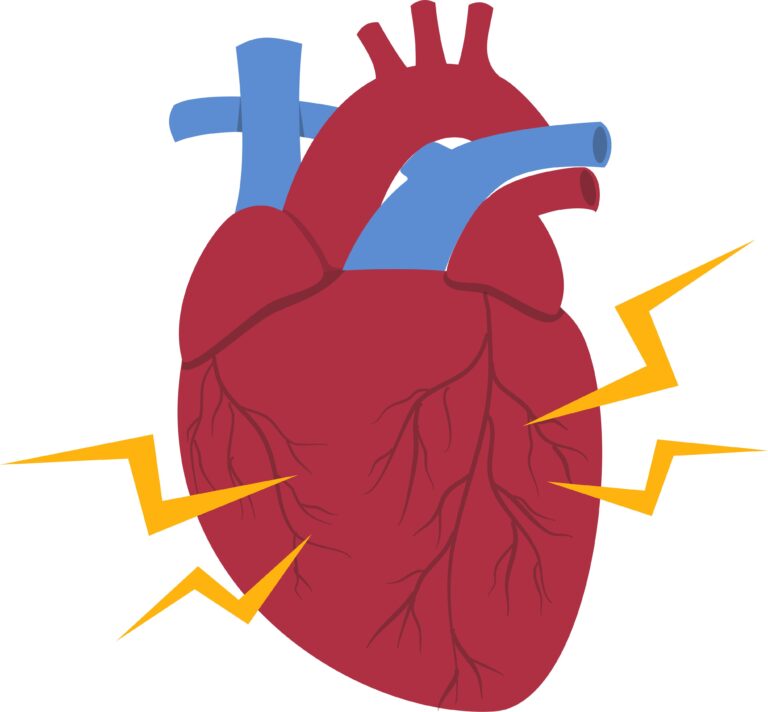 Medical illustration for Diabetic Cardiomyopathy: The Silent Destruction of the Heart Muscle by