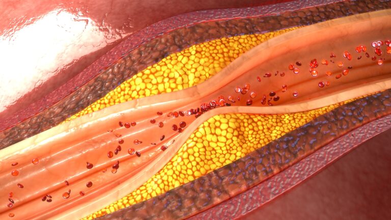 Medical illustration from Vitals Daily