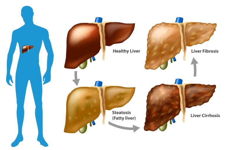 Medical illustration from Vitals Daily