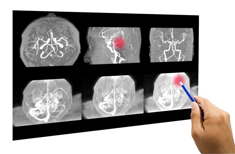 Medical illustration from Vitals Daily