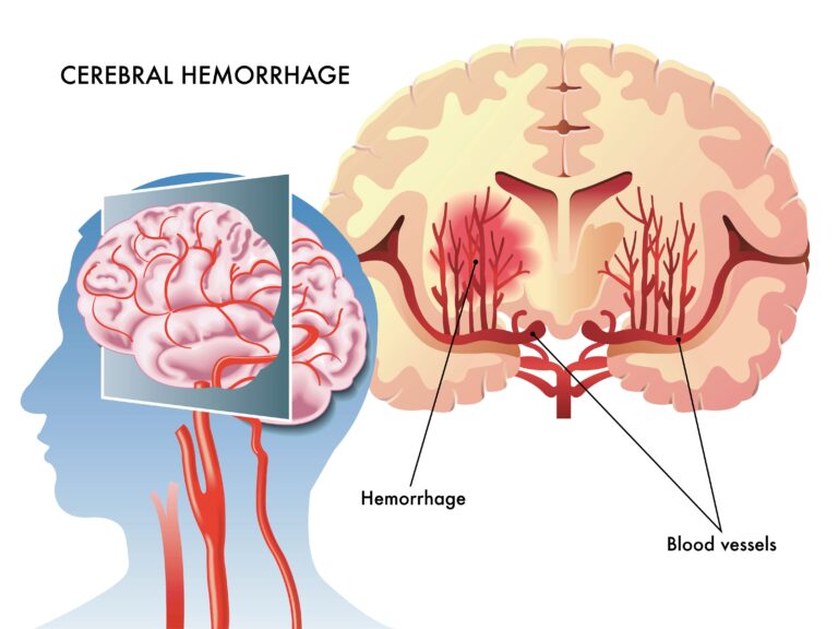 Medical illustration from Vitals Daily