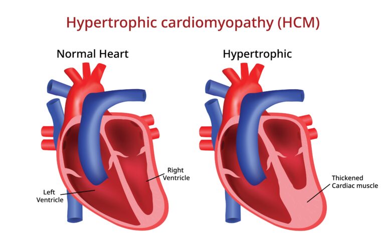 Medical illustration from Vitals Daily